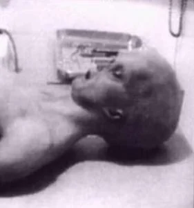 A autópsia do ET de Roswell: fraude