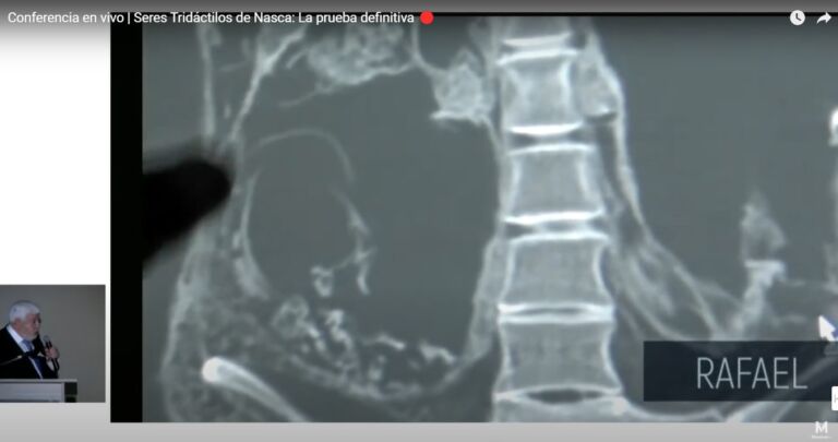 Maussan mostra radiografia de Mumia de Nazca onde investigador aponta a presença de um possível feto (Reprodução/TV Maussan/Youtube)