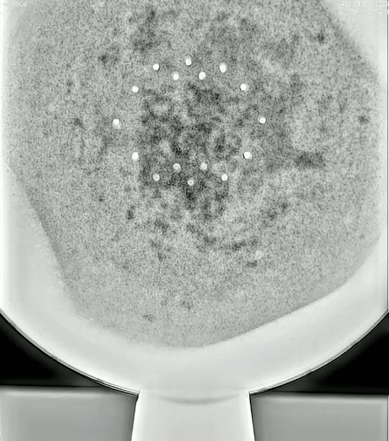 Sai análise de raios-x do misterioso OVNI 'Esfera de Buga'. Mas especialista aponta problemas 4 Imagem de raios-x do interior da esfera de Buga: estrutura em camadas, pontos que se destacam, composição maciça (Reprodução: Maussan Television)